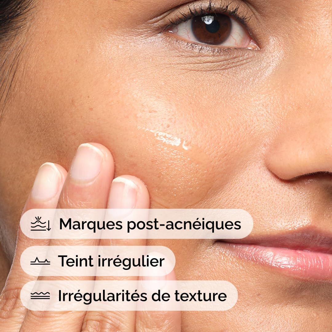 The Ordinary - Aloe 2% + NAG 2%